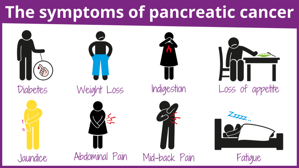 Symptoms of pancreatic cancer. Full text below