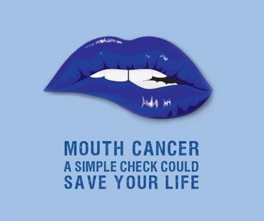 Mouth cancer, a simple check could save your life